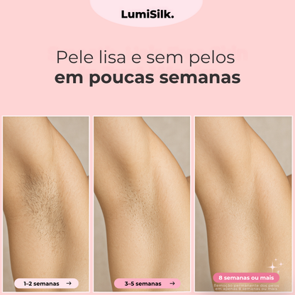 Resultados antes e depois com Lumina – pele lisa e sem pelos em apenas 8 semanas usando tecnologia IPL.