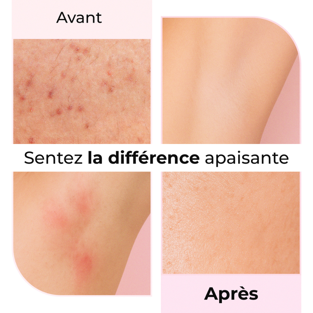 Résultat avant/après de l’utilisation de l’huile LumiSilk - Réduction visible des irritations post-rasage.