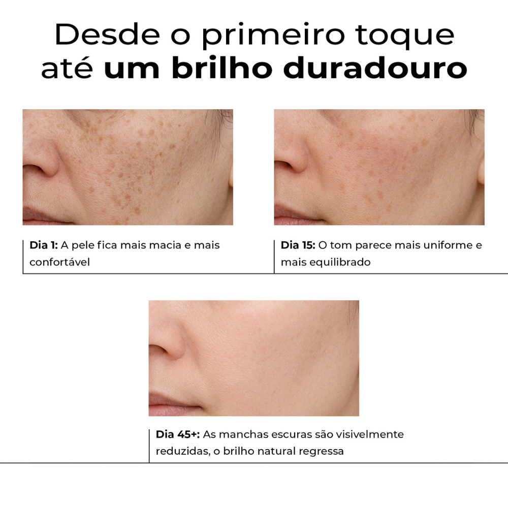 Evolução dos resultados com o Lumen Drop da LumiSilk: Dia 1 com pele mais macia, Dia 15 com tom mais uniforme e Dia 45+ com redução visível de manchas escuras e brilho natural restaurado.